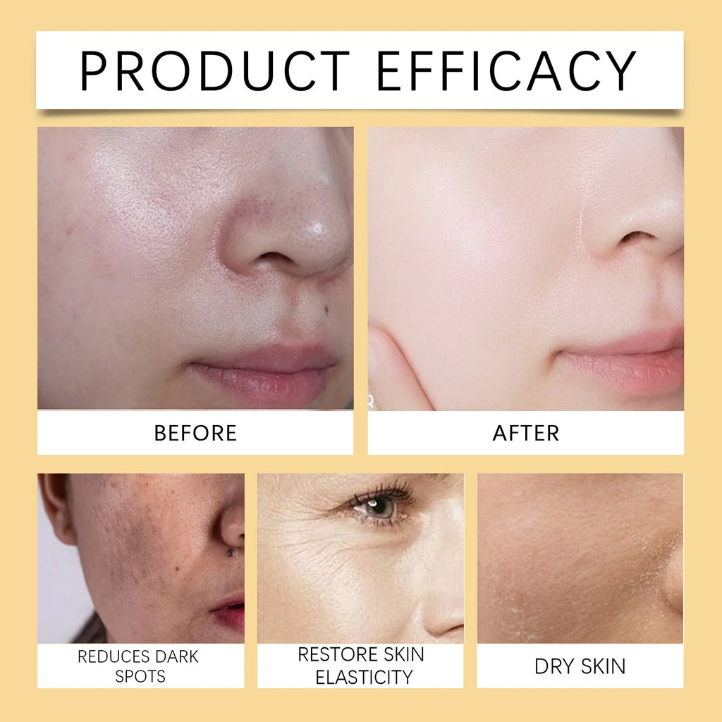 Hoygi Brightening Turmeric Face Moisturizer for Dry Sensitive Skin Hydrating Vitamin C Cream Anti Aging Daily Skincare Routine Zpaxo
