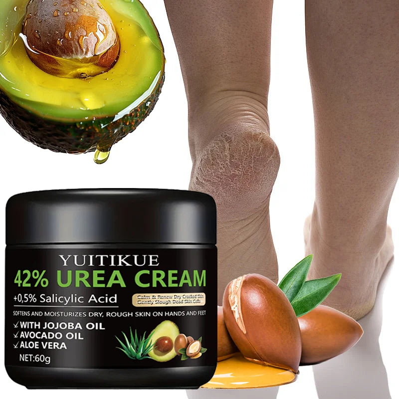 Urea Foot Cream – Repair Cracked Heels & Moisturize Dry Skin Foot Cream Zpaxo