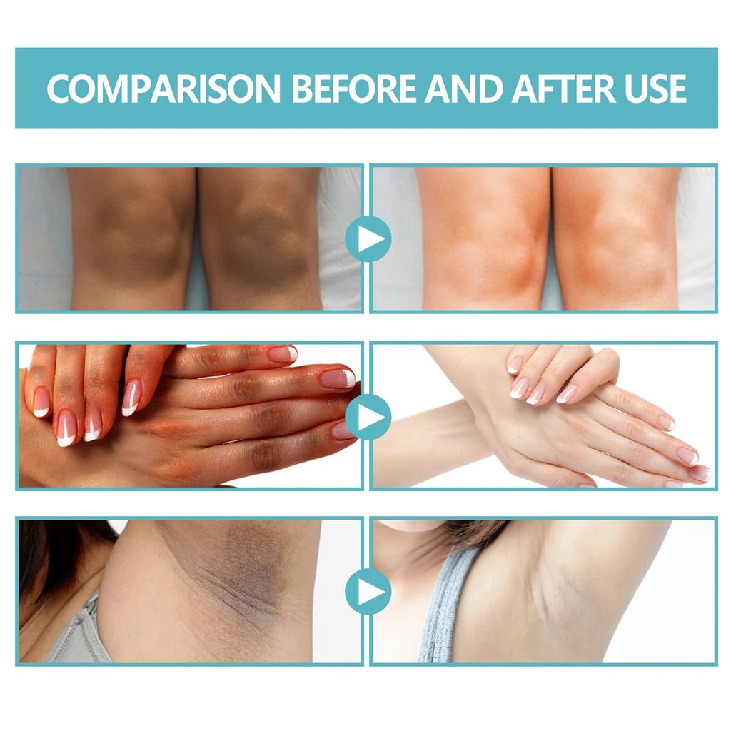 EELHOE Whitening Cream – Body Brightening for Dark Skin Skin Brightening Cream Zpaxo