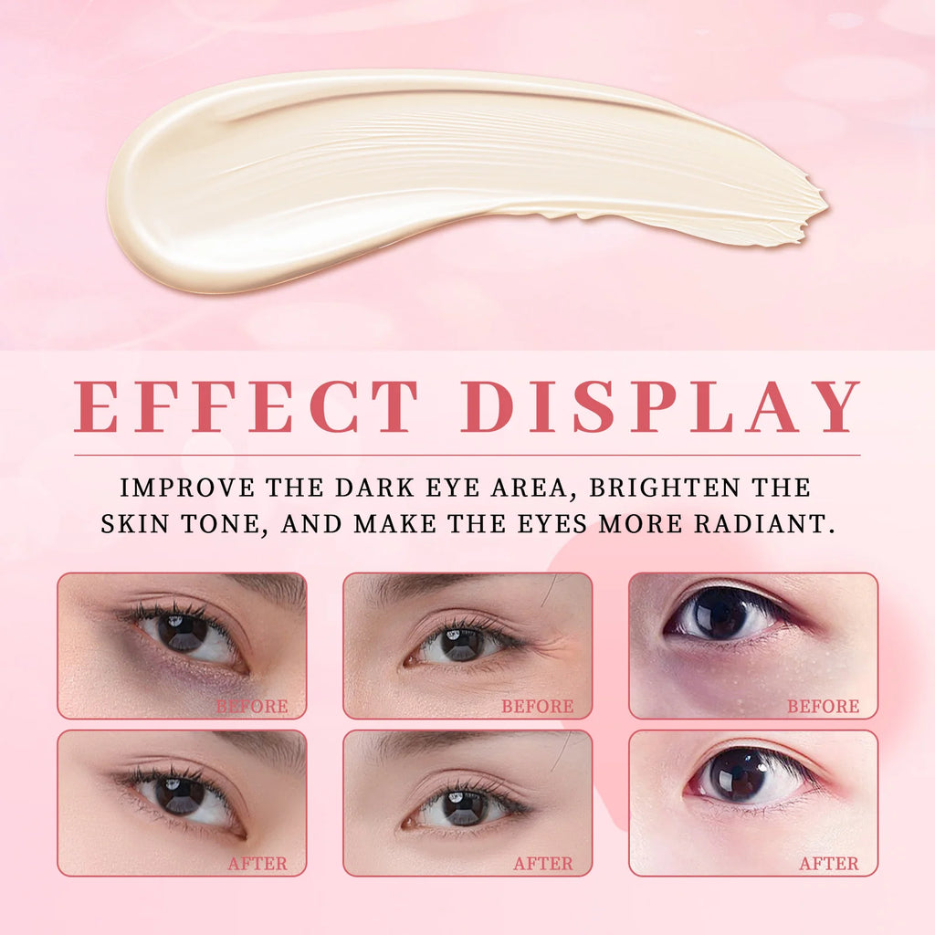 Electric Cooling Eye Massage Cream Anti-wrinkle Firming Gel Roller Zpaxo