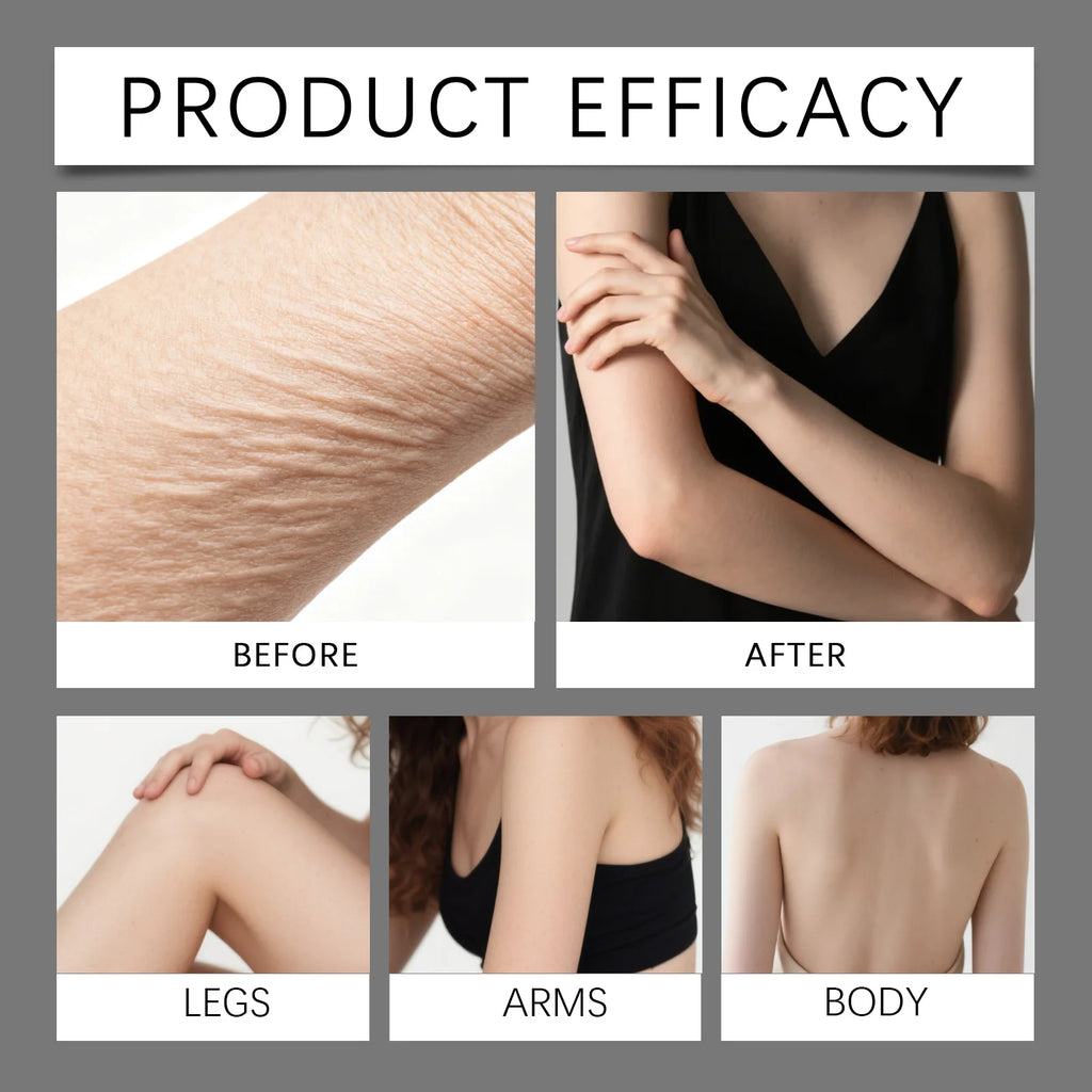 Cellulite Body Oil Skin Smoothing Oil Moisturizing Dry Skin Improve Skin Texture Anti Aging Body Care Oil with Citrus Oils Zpaxo