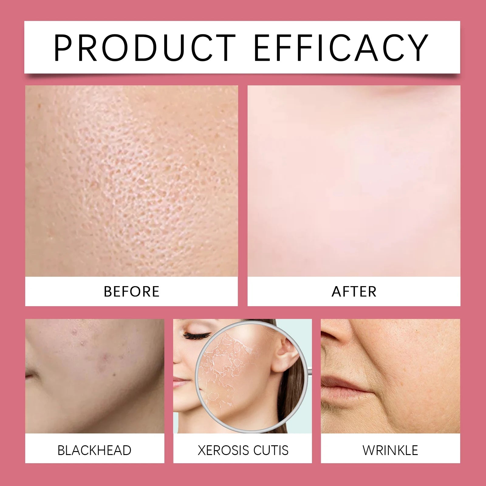 0.25mm Microneedle Roller Facial Serum Vitamin E Deep Hydration Lock Moisturizer Gentle Nourishing Soothing Redness Skincare Zpaxo