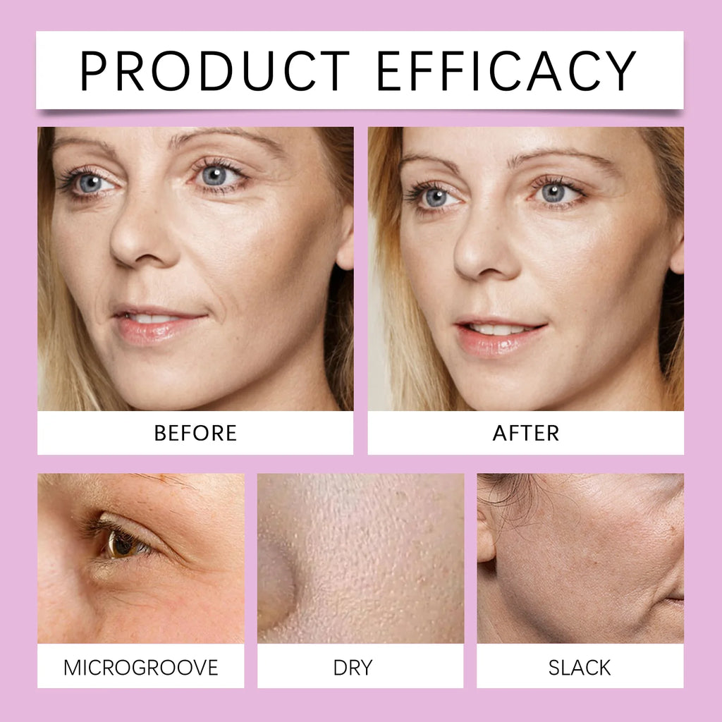EELHOE Collagen Lifting Serum – Anti-Wrinkle & Hydration Anti-Aging Face Serum Zpaxo