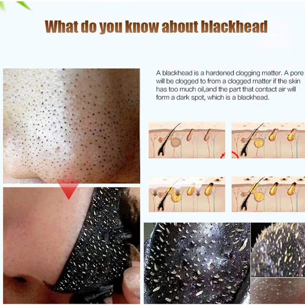 Plant Extraction Blackhead Remover Peel-Off Mask | All Skin Types Blackhead Peel Mask Zpaxo