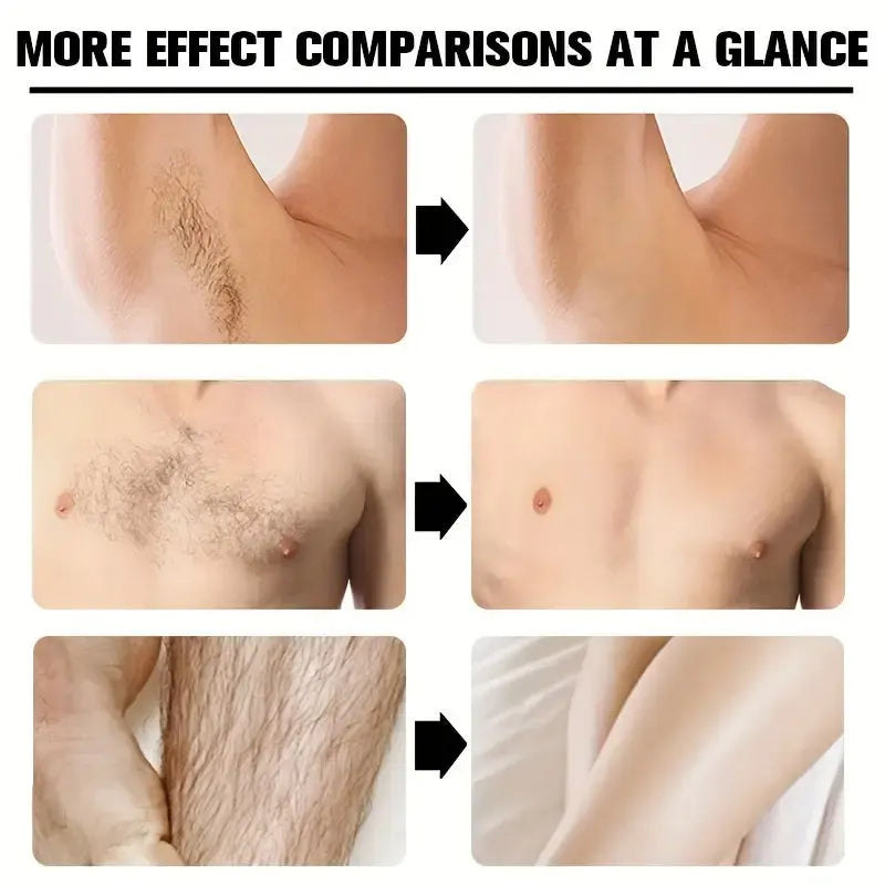 YUITIKUE Men's Hair Removal Cream – Painless & Nourishing 100g Hair Removal Cream Zpaxo