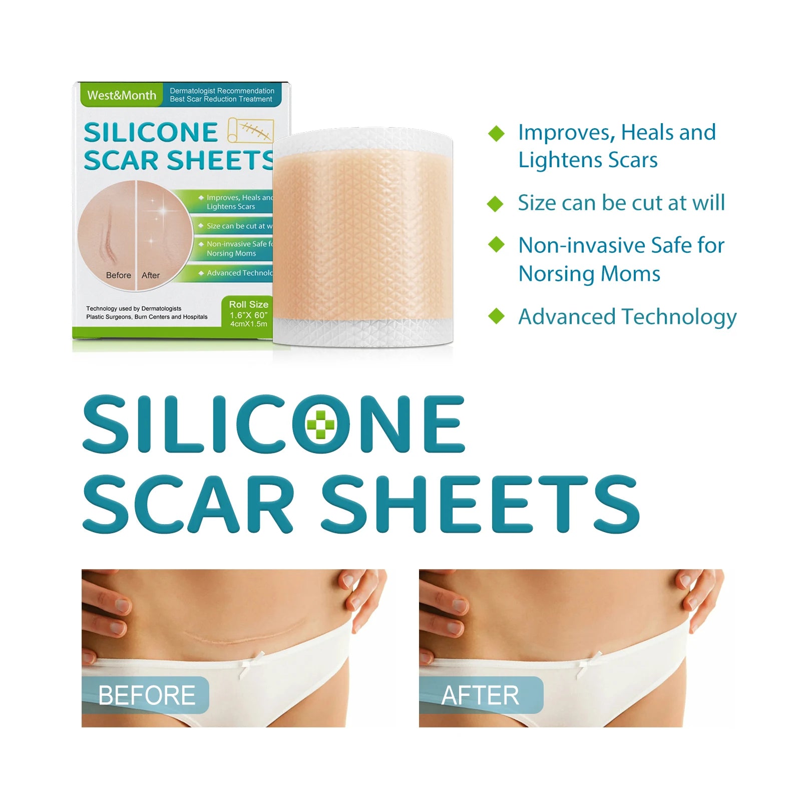 1 Roll Silicone Scar Sheets , 4cmX150cm Self-Adhesive Scar Cover Tape Reusable and Effective Skin Care Strips Zpaxo