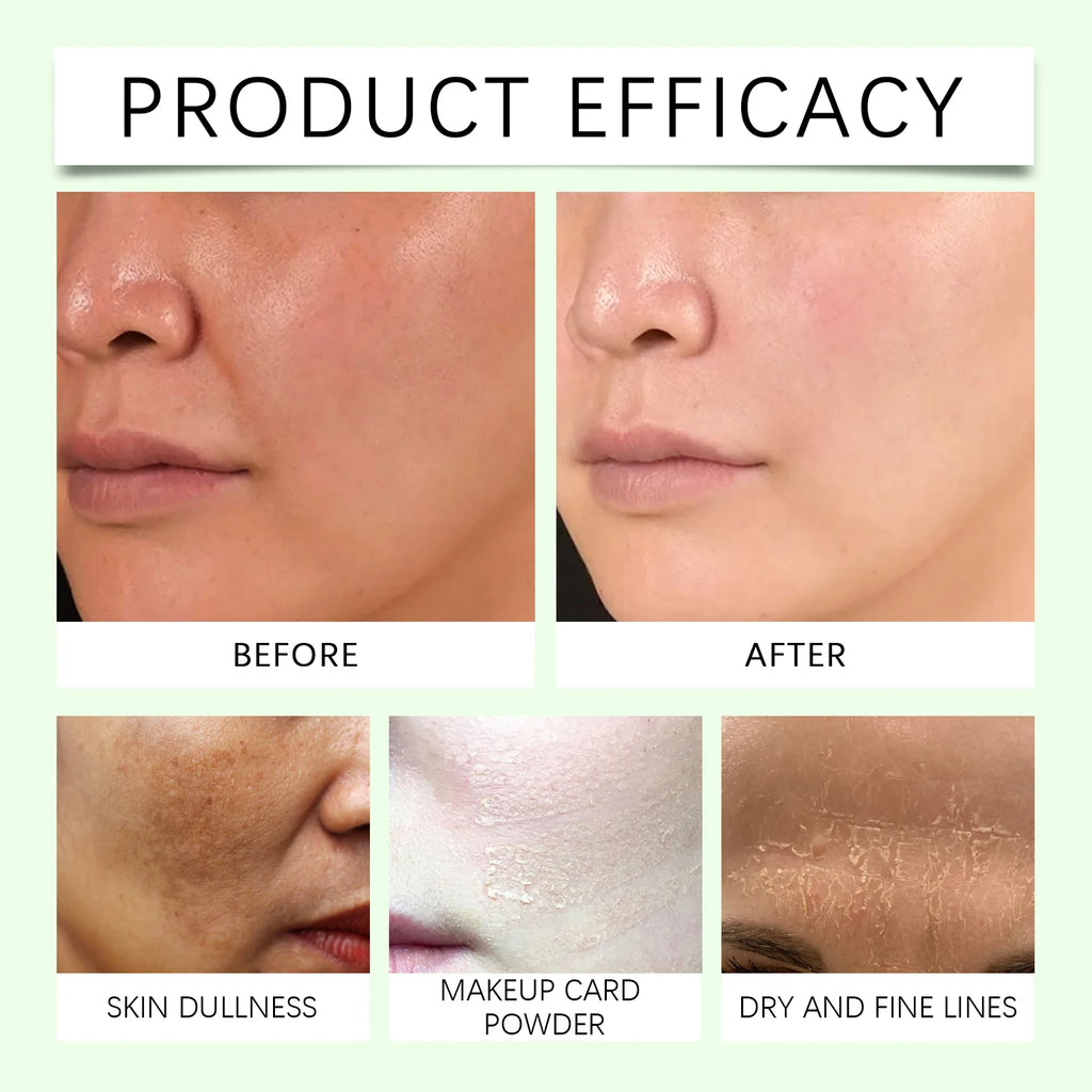 Moisturizing Lotion - Daily Facial Moisturizing Care Lotion for Hydrating, Nourishing, Brightening and Refining Skin Zpaxo