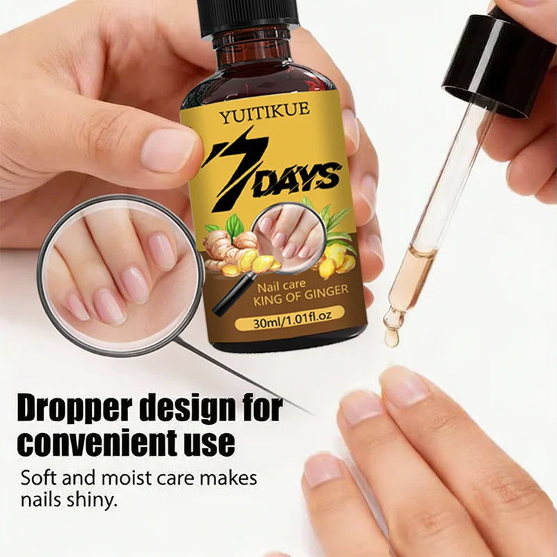 YUITIKUE 7-Day Ginger Nail Care Oil – Nourish & Strengthen 30ml Nail Treatment Oil Zpaxo